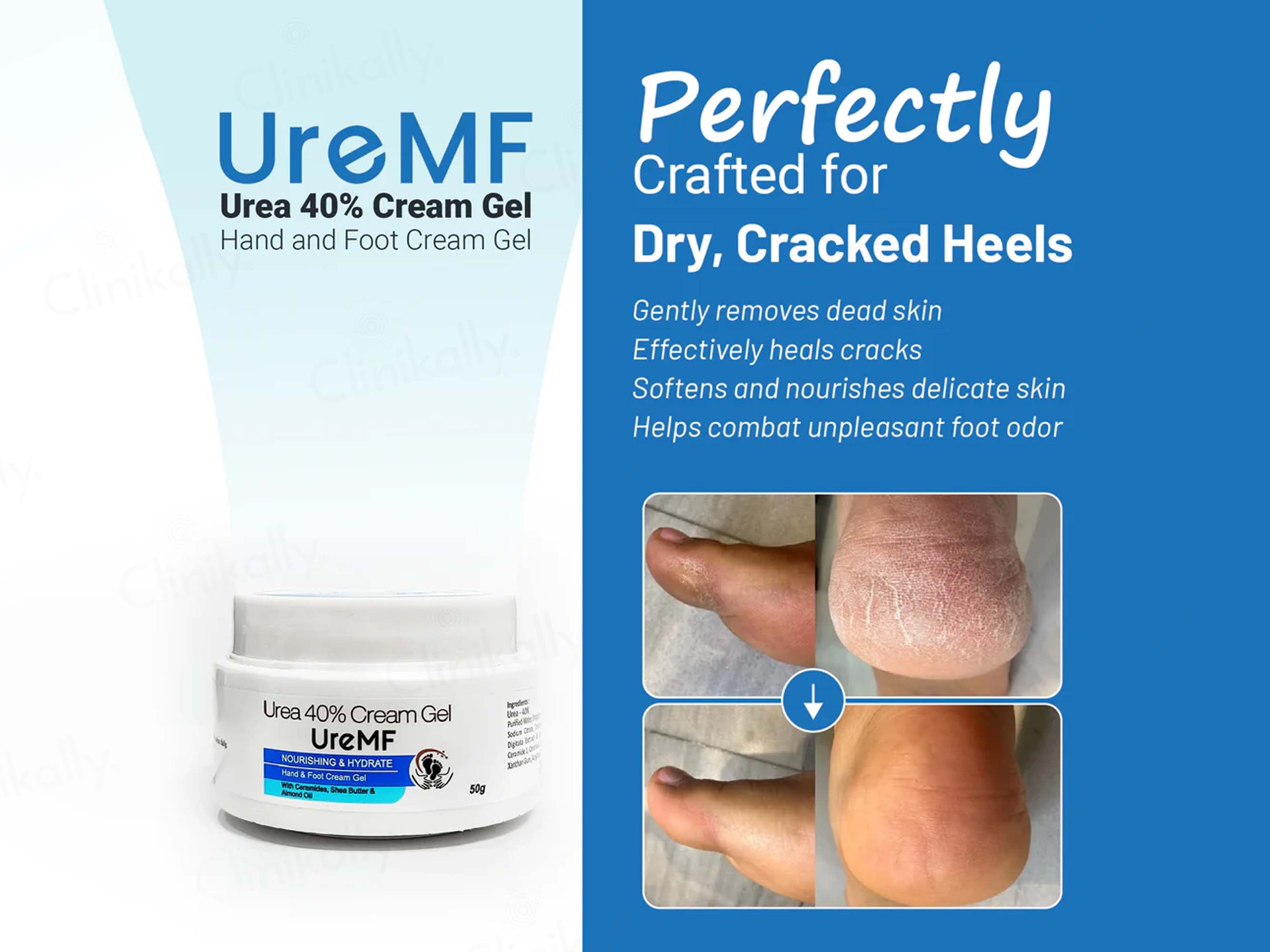 UreMF 40% Urea Hand & Foot Cream Gel