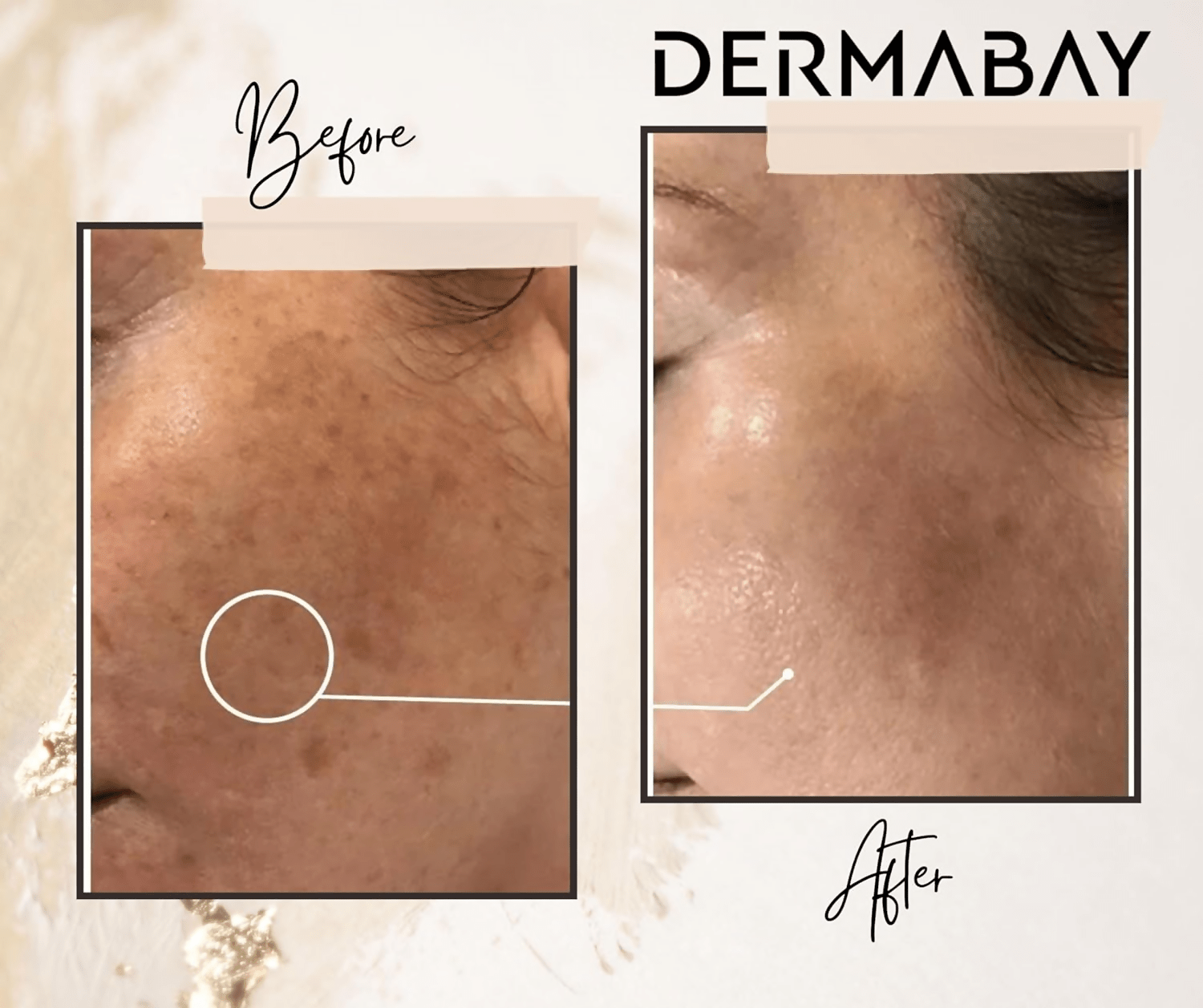 Dermabay Skin Brightening Face Serum With Kojic Acid & Alpha Arbutin - Vamzn#