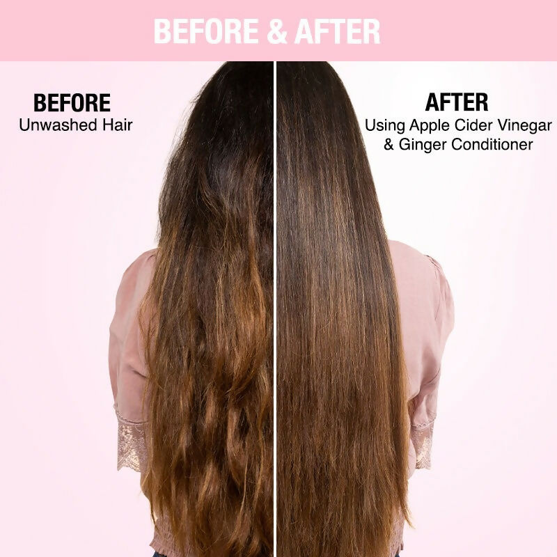 Nykaa Naturals Anti-Dandruff-Free Conditioner With Apple Cider Vinegar & Ginger