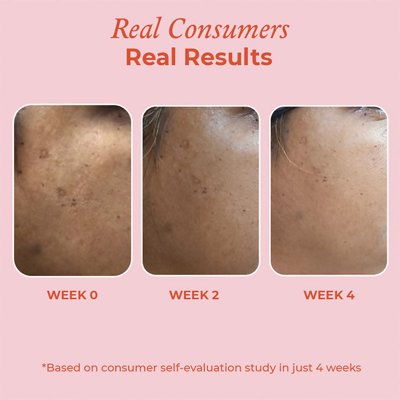 The Pink Foundry 15% Vitamin C Brightening Serum