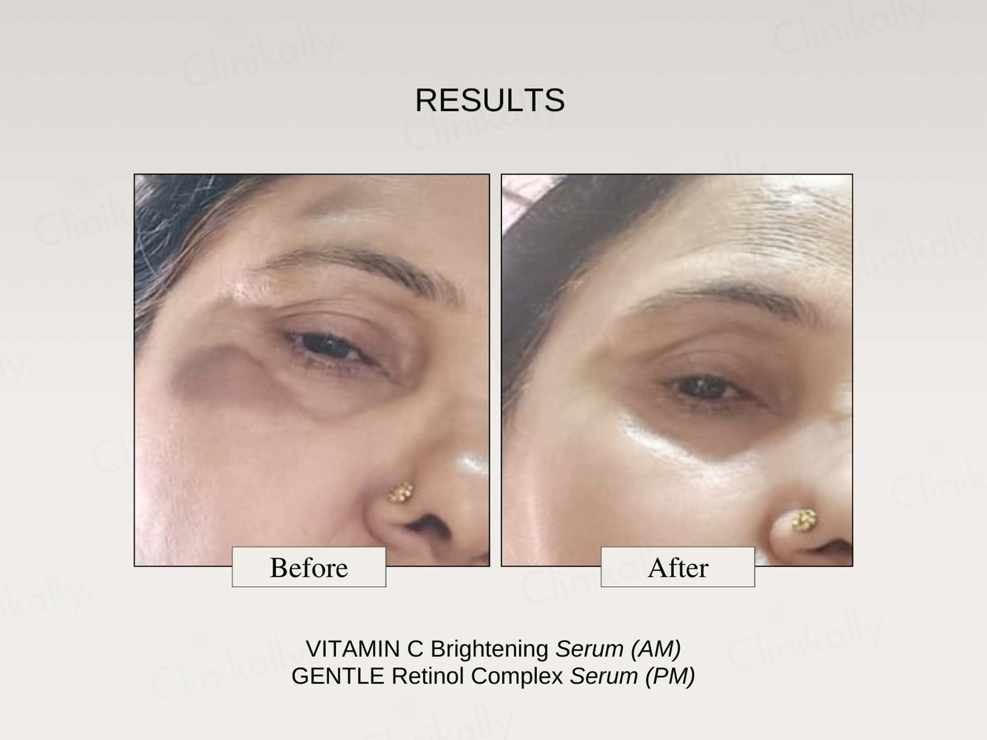 The FormulaRx Vitamin C Brightening Serum