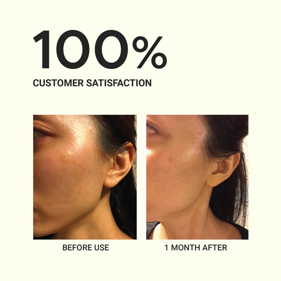 PureAm Authentic Barrier Cream Balm (Moisturizer)