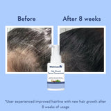 Wishcare Hair Growth Serum Concentrate With 3% Redensyl, 4% Anagain, Rice Water, Biotin