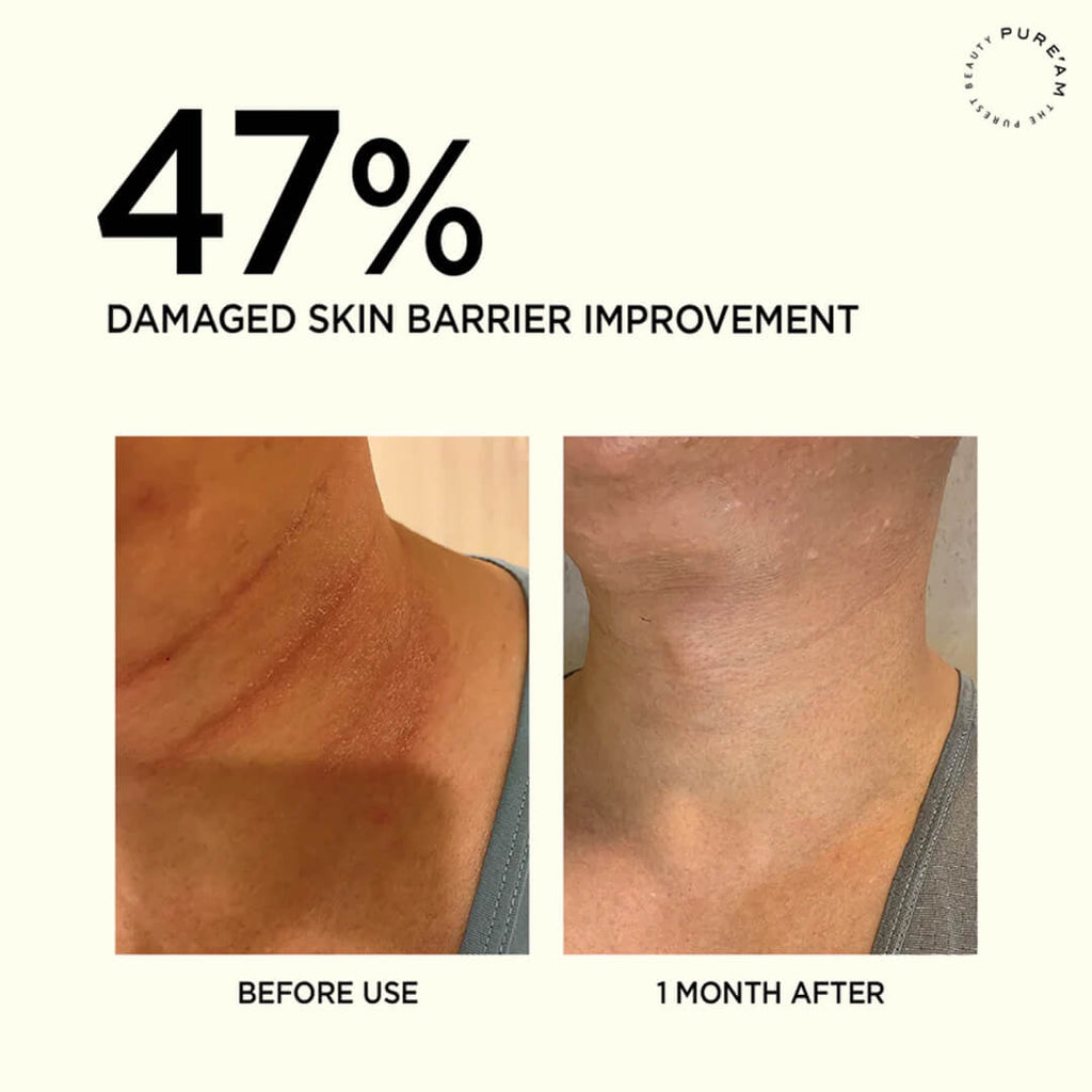 PureAm Authentic Barrier Cream Balm (Moisturizer)