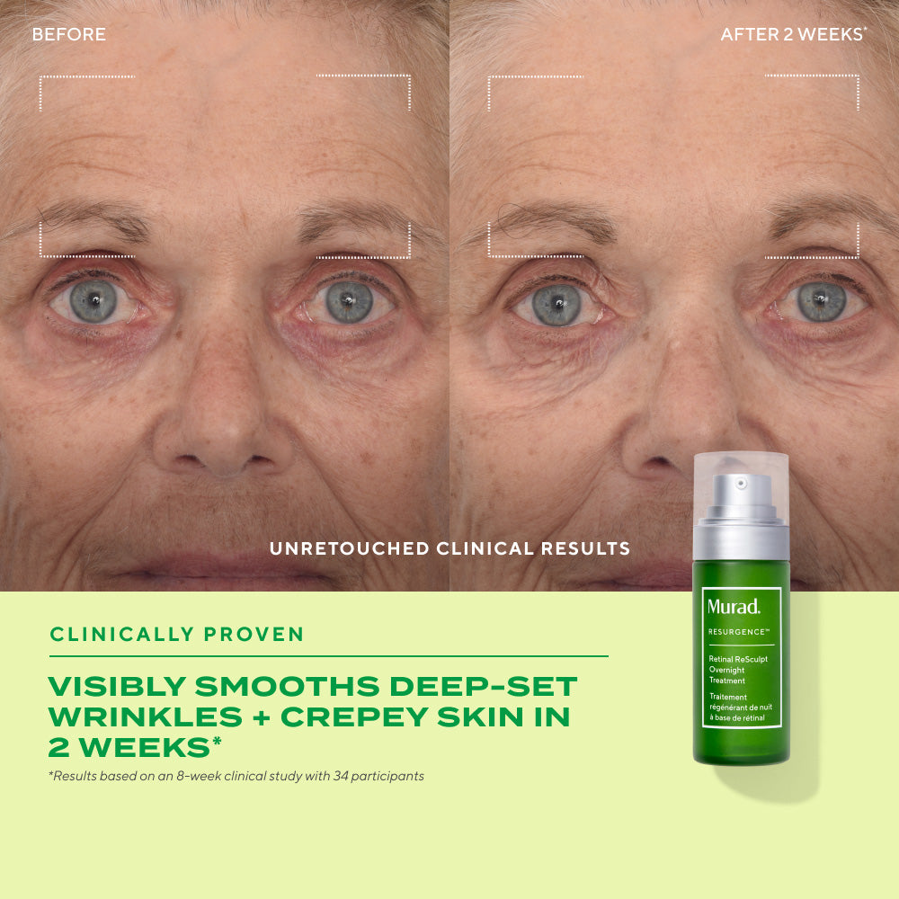 Murad Retinal ReSculpt Overnight Treatment (30ml)