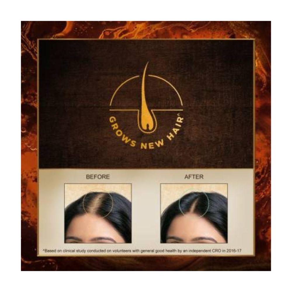 Indulekha Bhringa Hair Oil ( 5 Pack )
