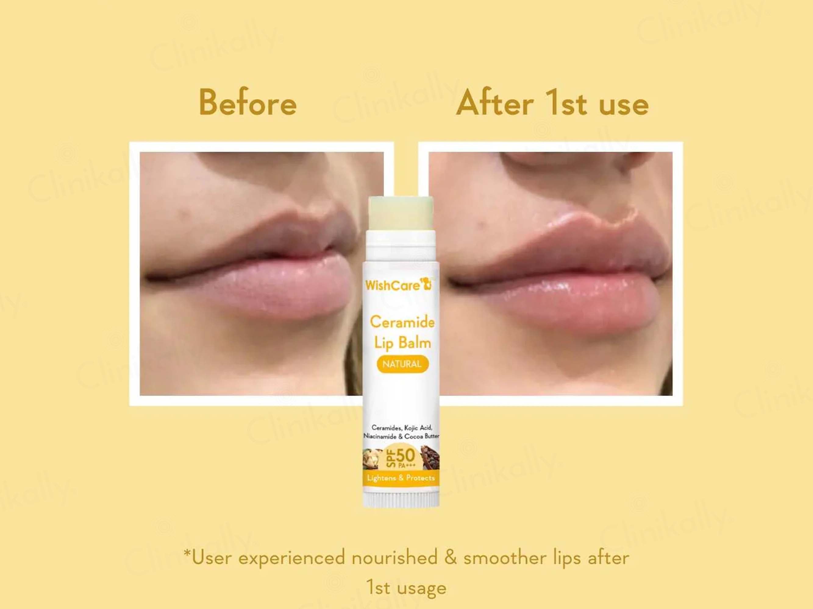 WishCare Ceramide Lip Balm - Natural SPF 50 PA+++