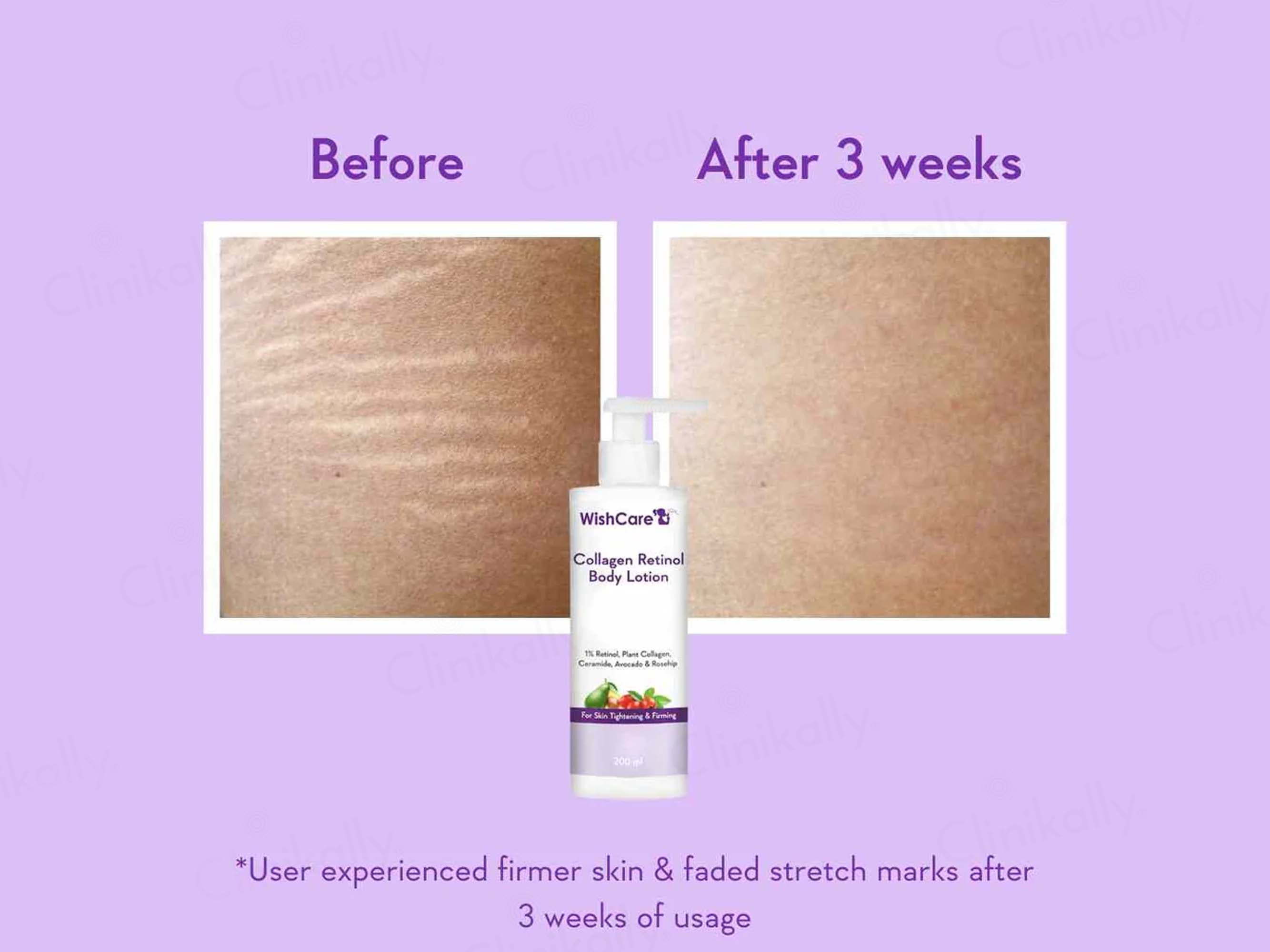 WishCare Collagen Retinol Body Lotion