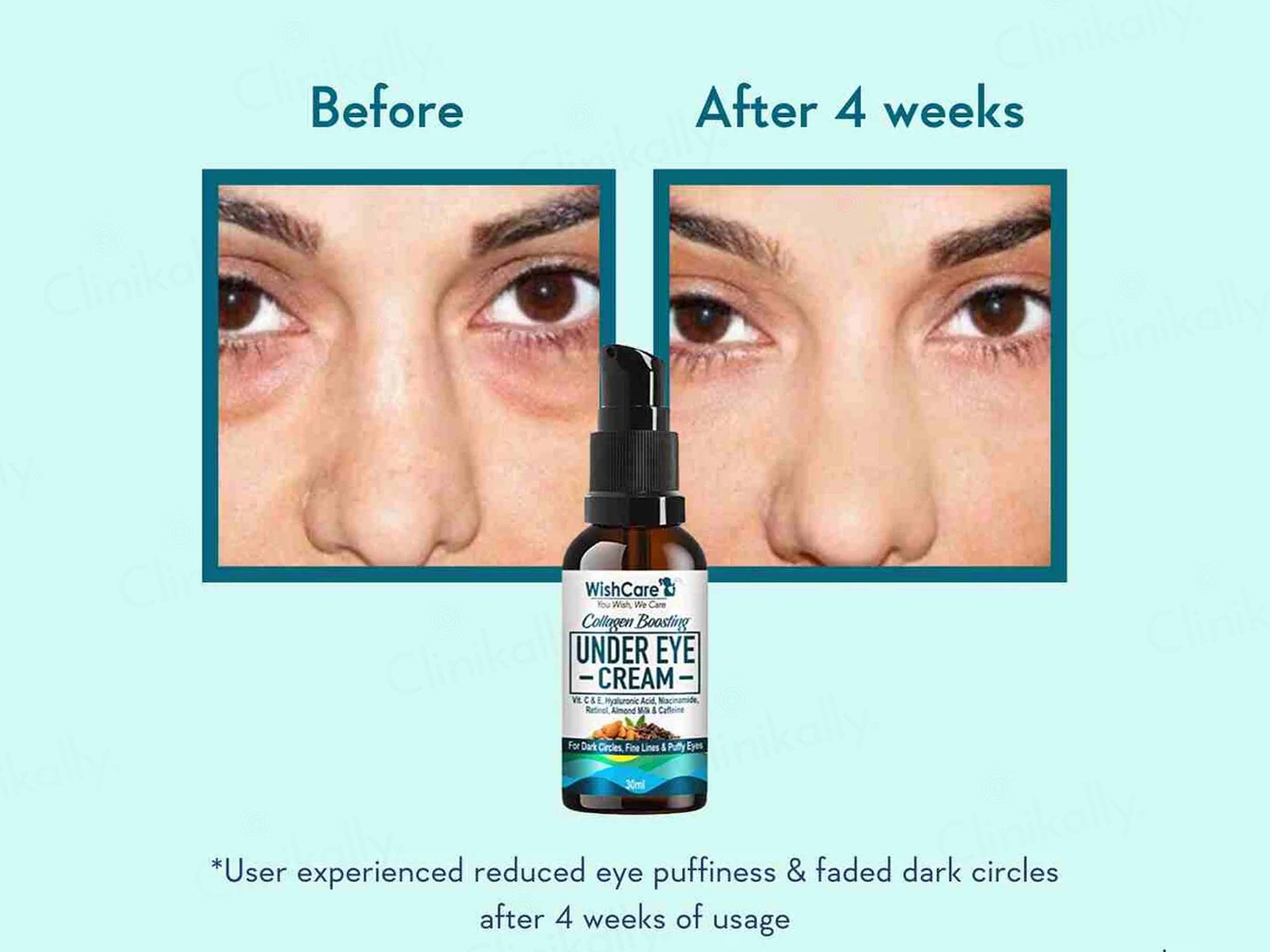 WishCare Collagen Boosting Under Eye Cream