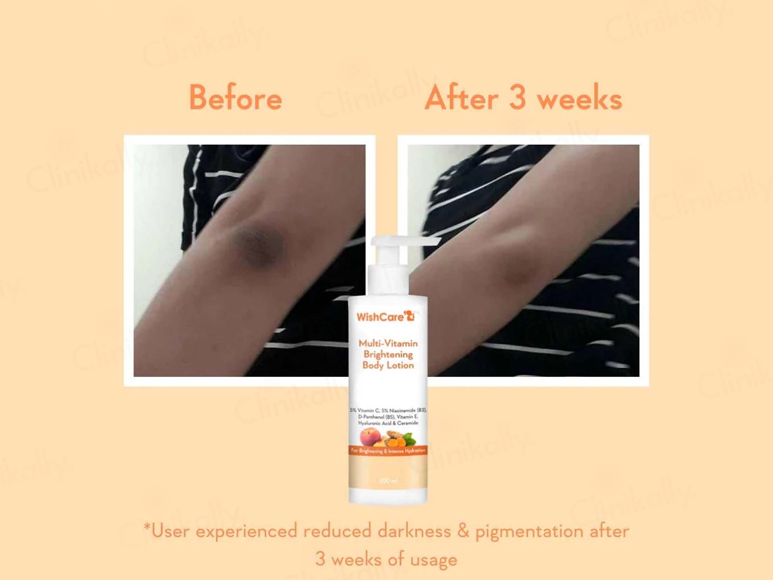 WishCare Multi-Vitamin Brightening Body Lotion