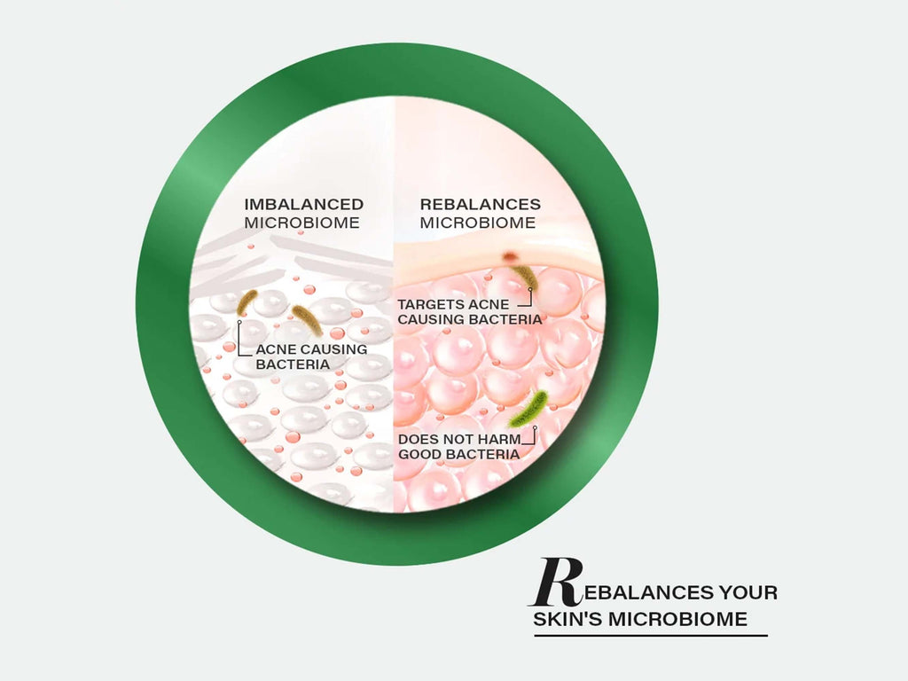 Novology Acne Clearing Serum