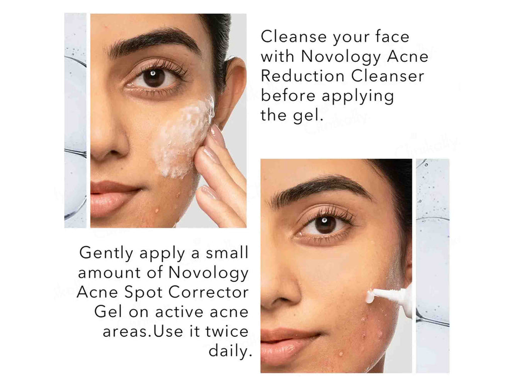 Novology Acne Spot Corrector Gel
