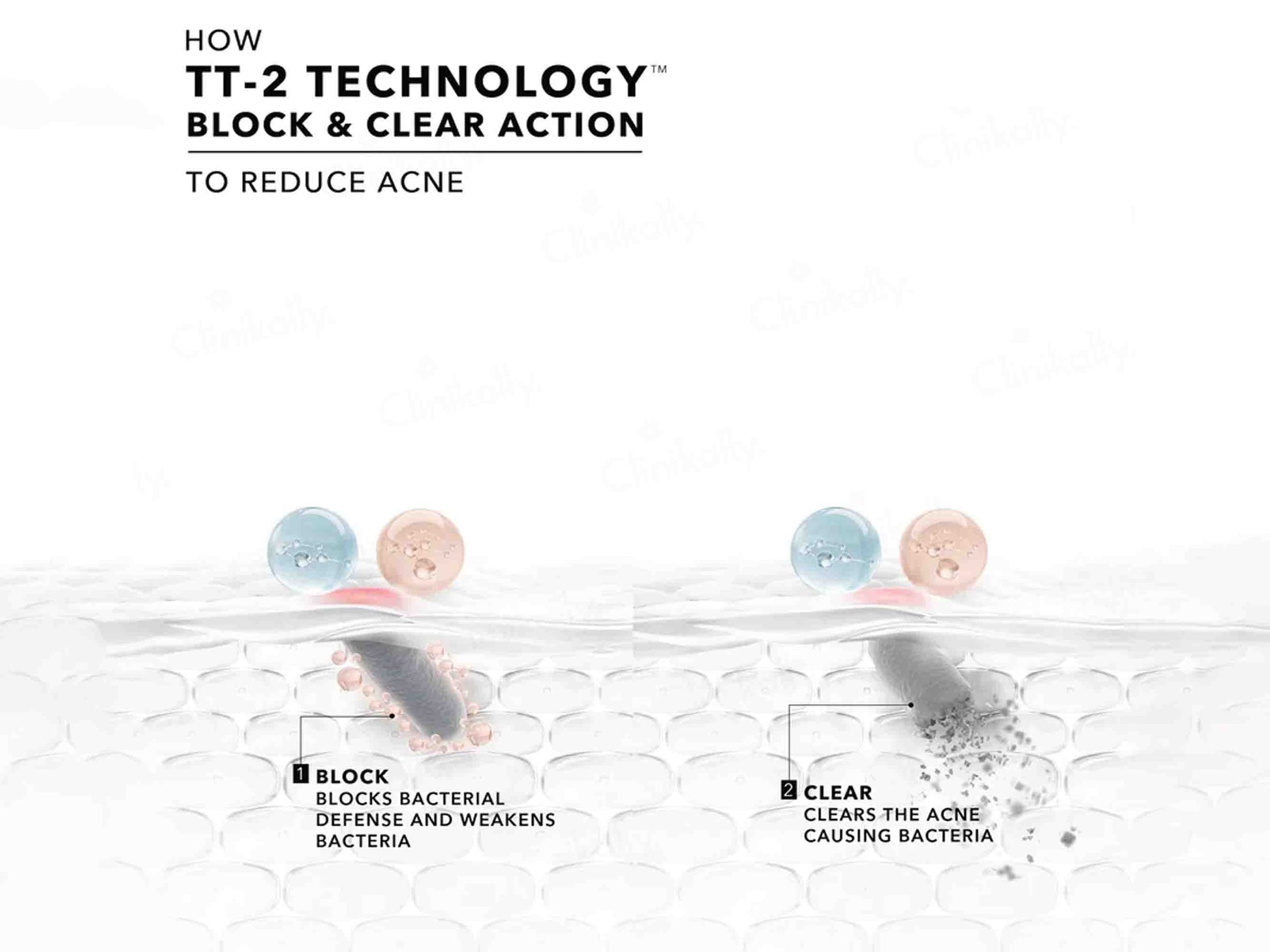 Novology Acne Spot Corrector Gel