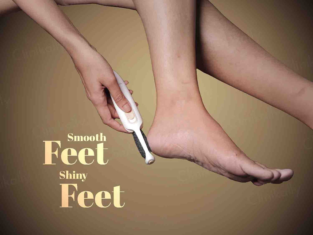 Winston Callus Remover