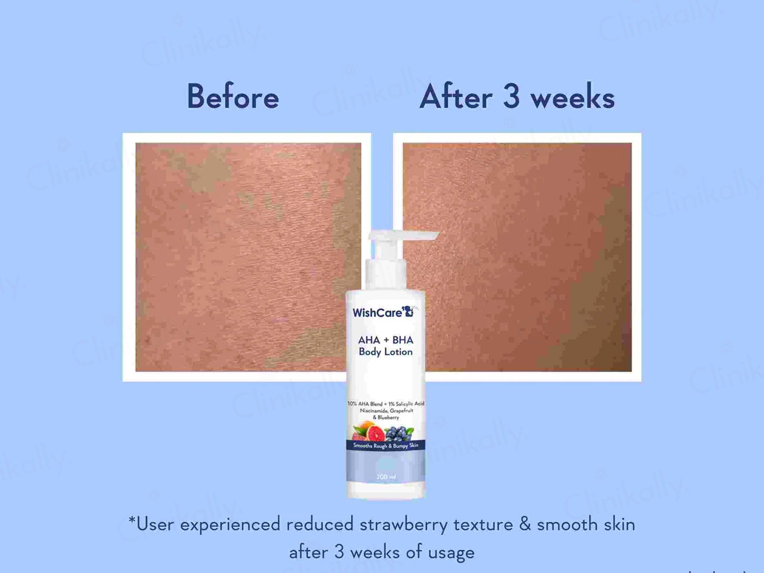 WishCare AHA + BHA Body Lotion
