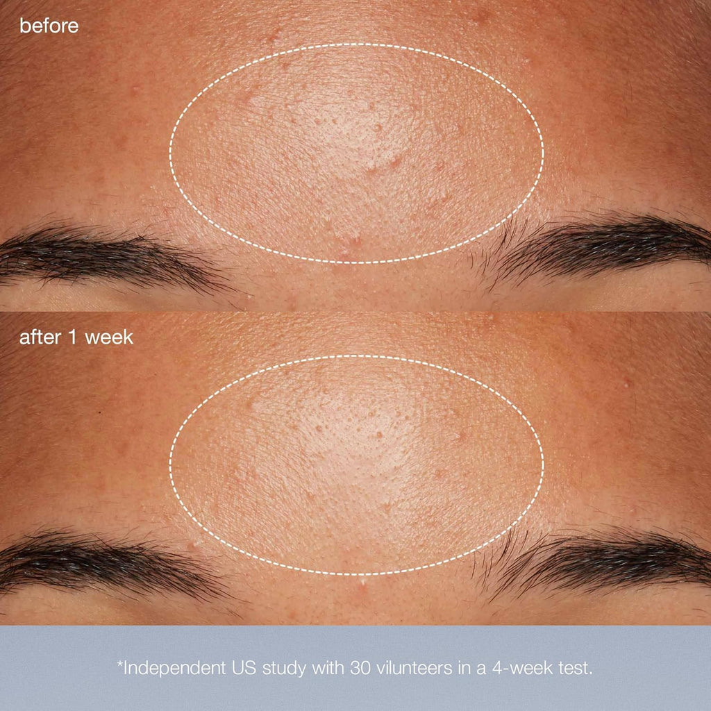 Dermalogica Daily Microfoliant, Face Exfoliator Scrub Powder with Salicylic Acid and Papaya Enzyme, Achieve Brighter, Smoother Skin Daily - Vamzn#