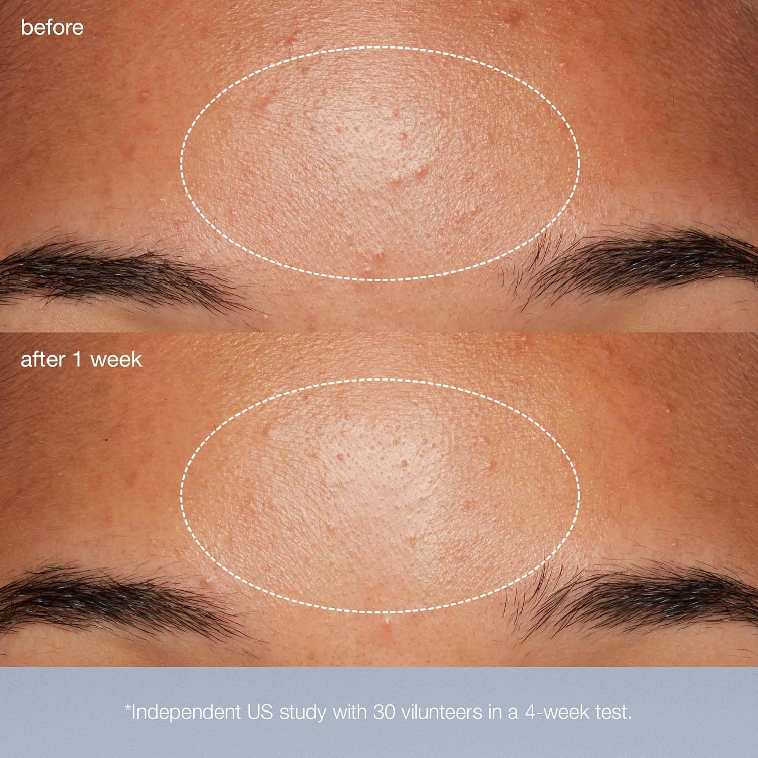 Dermalogica Daily Microfoliant, Face Exfoliator Scrub Powder with Salicylic Acid and Papaya Enzyme, Achieve Brighter, Smoother Skin Daily - Vamzn#