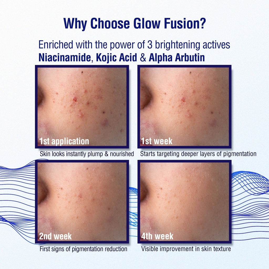 Dermdoc 2% Kojic Acid Night Cream - Vamzn#