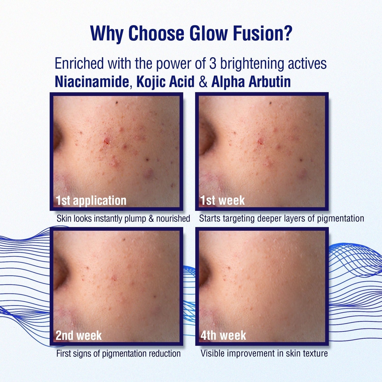Dermdoc 2% Kojic Acid Night Cream - Vamzn#
