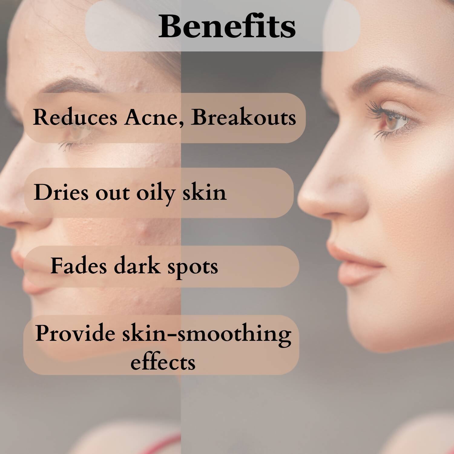 Dermistry Mattifying Moisturizer & Anti Acne Foaming Face Wash - Vamzn#
