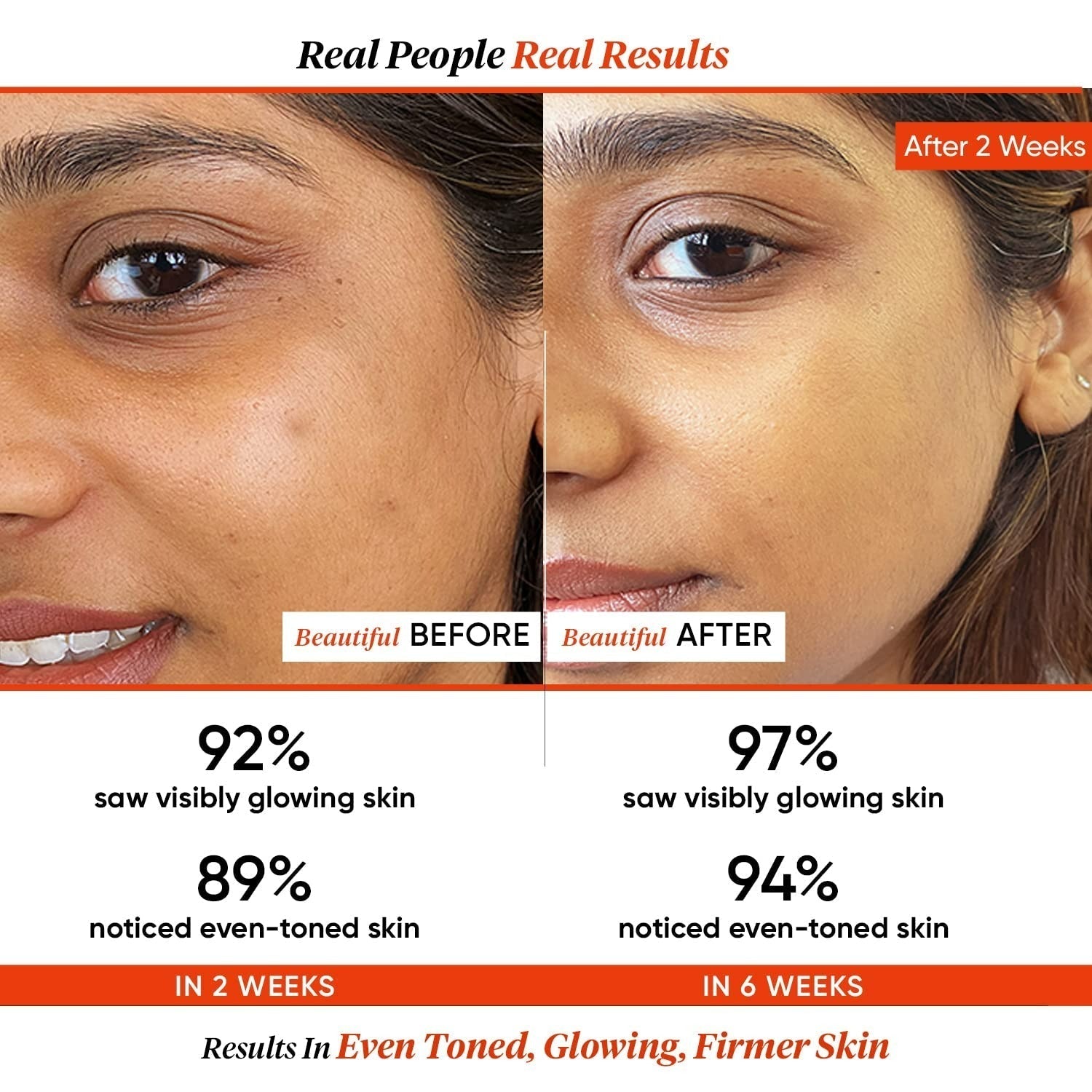 Dot & Key 20% Vitamin C Face Serum with Blood Orange, Skin Glow, Fights Pigmentation & Reduce Dark Spots - Vamzn#