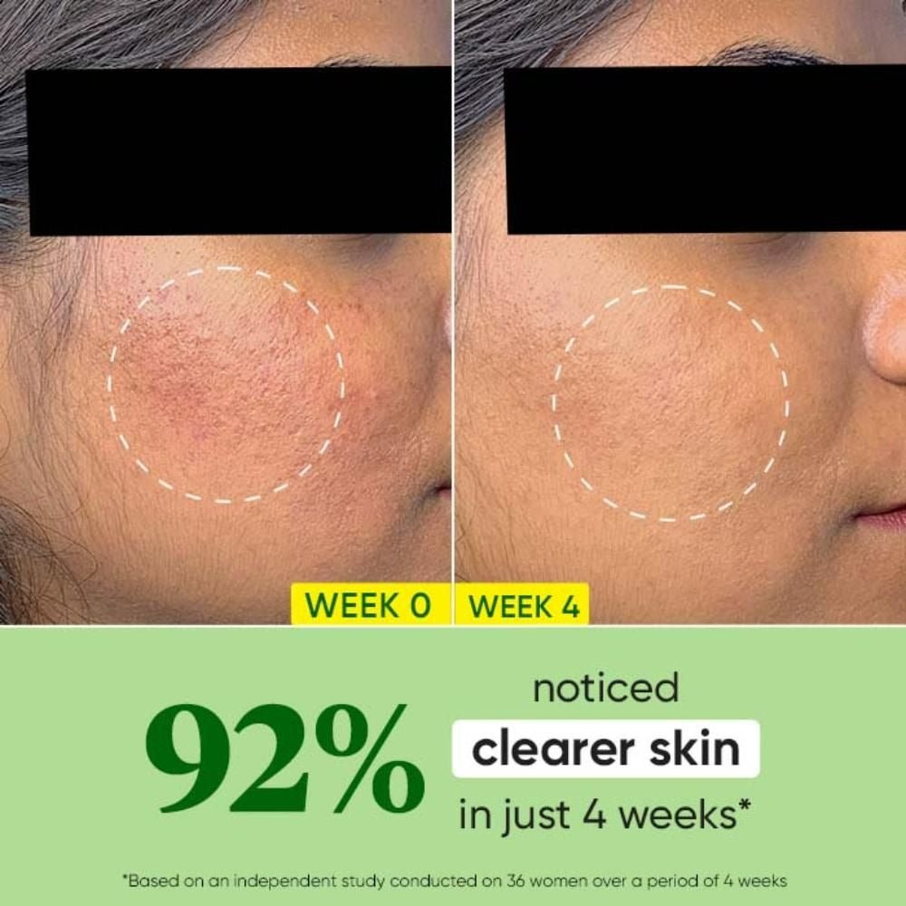 Dot & Key CICA +Niacinamide Oil Free Moisturizer - Vamzn#