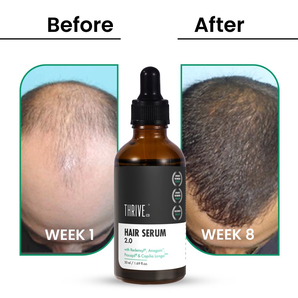 ThriveCo Hair Growth Serum 2.0