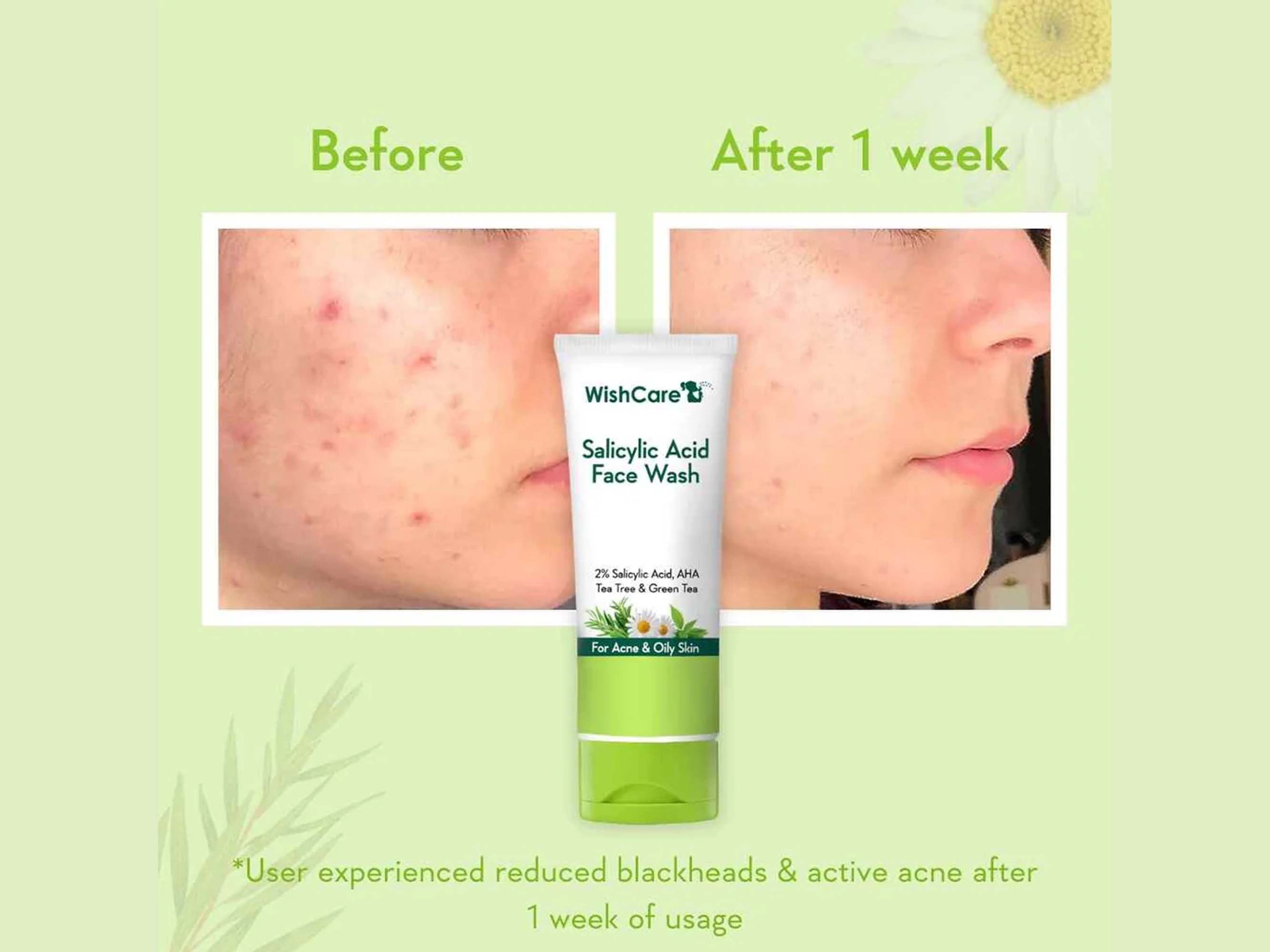 WishCare Salicylic Acid Face Wash